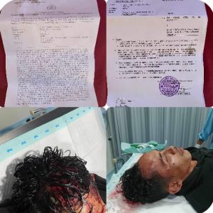 Korban Penganiayaan Meminta Polsek Talang Padang Segera Tangkap Pelaku