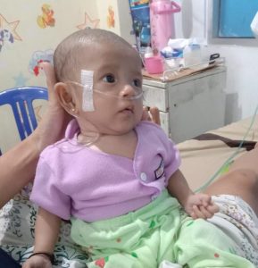 Bayi Mungil Asal Tanggamus, Berjuang Melawan Jantung Bocor, Butuh Uluran Tangan Dermawan